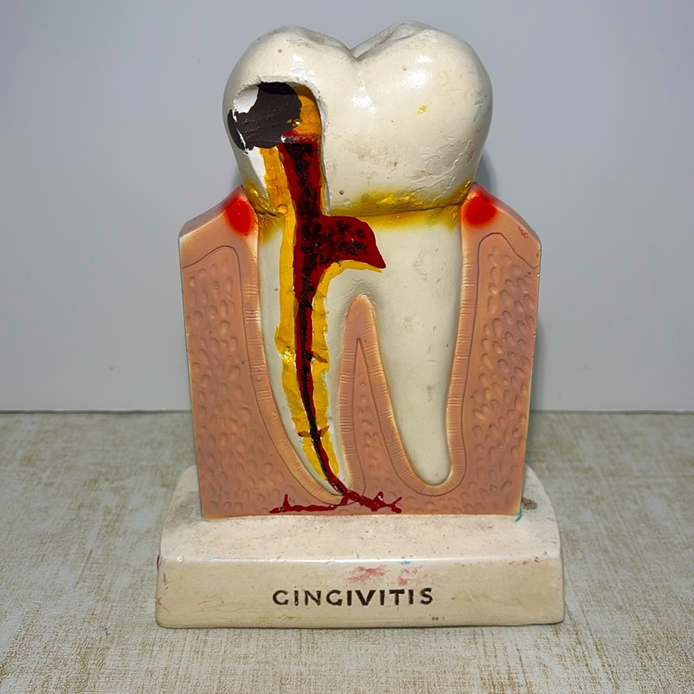 Procter & Gamble Vintage Tooth Model for Gingivitis 1960's (By Crest)